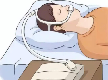 呼吸機治療：為OSAS患者守護甜美夢鄉